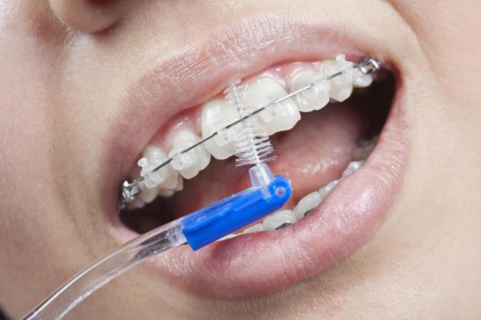 како очистити протезу четкицом за зубе