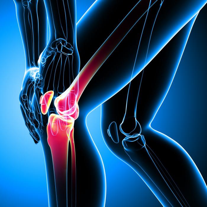 Ортопедични подложки за коляното за артроза