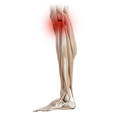 Zraněné koleno