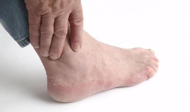 liječenje osteoartritisa od stopala zgloba