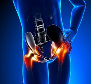osteoartritida příznaků kyčelního kloubu
