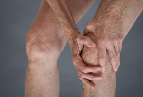 osteoartrite dell'articolazione del ginocchio di 3 gradi