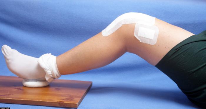 Liječenje osteoartritisa od stopala narodnim načinima