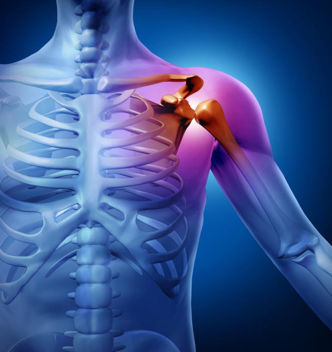 Liječenje artroze ramena: folk lijekovi i lijekovi