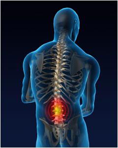 osteopatijo s kilo hrbtenice