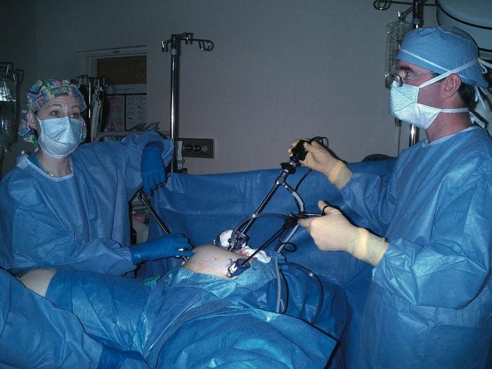 laparoskopowe torbiele jajników opinie