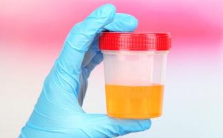 tasso di ossalato nelle urine di un bambino