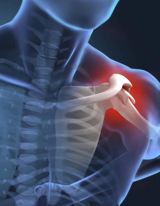 što uzrokuje bol u ramenu joint bol u svim zglobovima injekcije