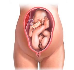 karlična prezentacija uzroka fetusa