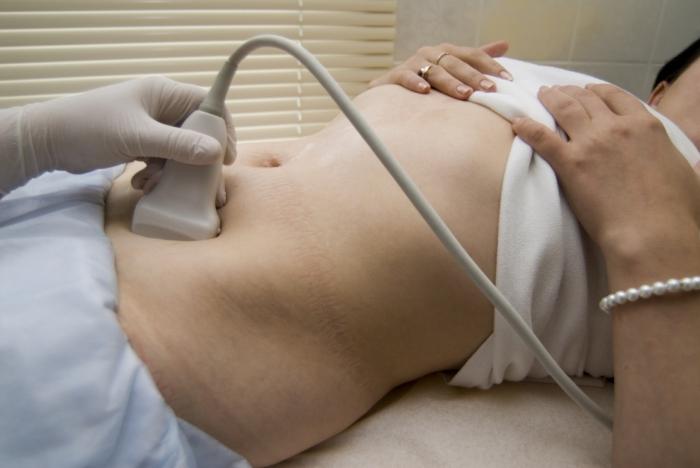 ultrazvuk pánve u žen