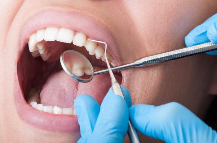 prevence parodontálních onemocnění