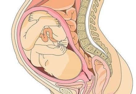 placenta na zadní straně dělohy