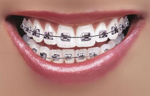 ploče na fotografiji zuba