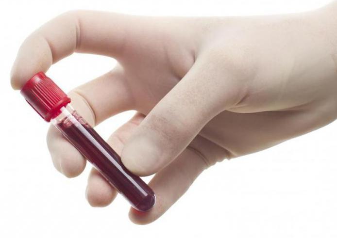 norma del trascritto test del sangue