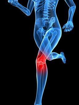 Posttraumatska artroza: što učiniti i kako liječiti bolesne zglobove