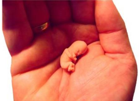бременност един месец след спонтанен аборт
