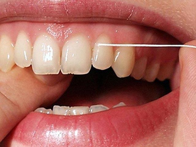 profesjonalne zalecenia dotyczące higieny jamy ustnej