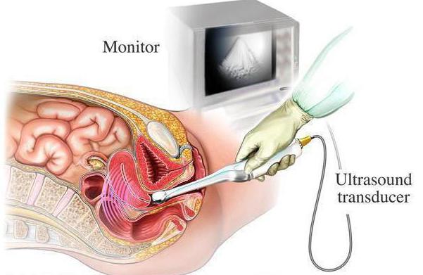 pripravo na ultrazvok ledvic, ki ga lahko jeste