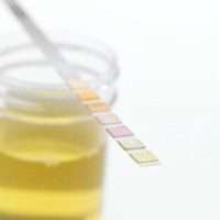 moške beljakovine v urinu