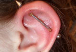 foto di puntura della cartilagine dell'orecchio