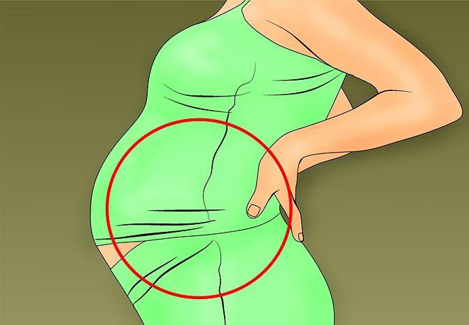 cannephron tijekom trudnoće