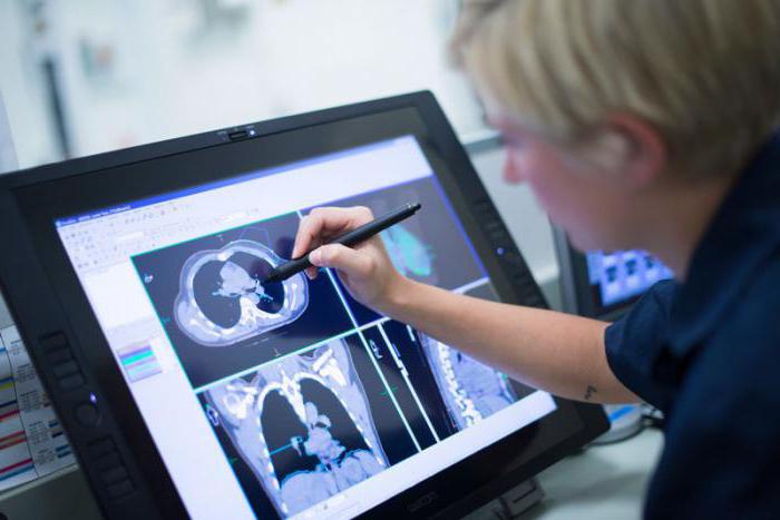 radiološka terapija v pregledih onkoloških učinkov
