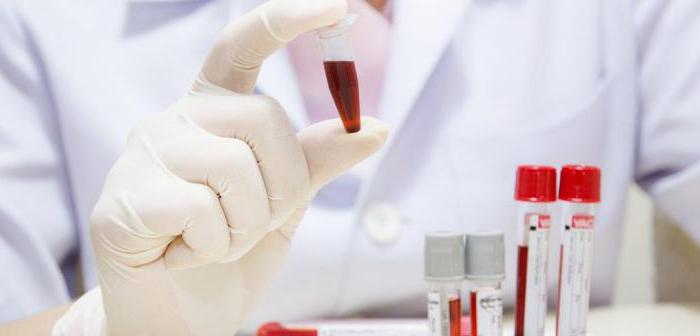 rdw è aumentato nell'analisi del sangue