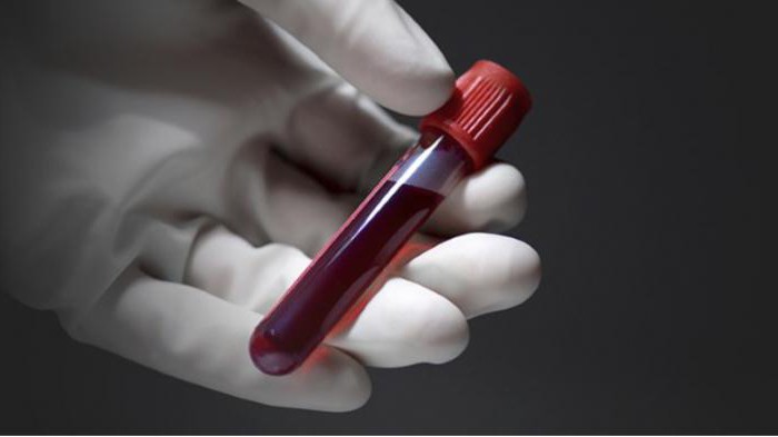 Rdw v krvnem testu je pri otroku povišan