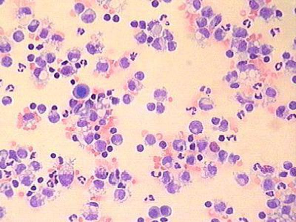 norma rdečih krvnih celic levkocitov v krvi