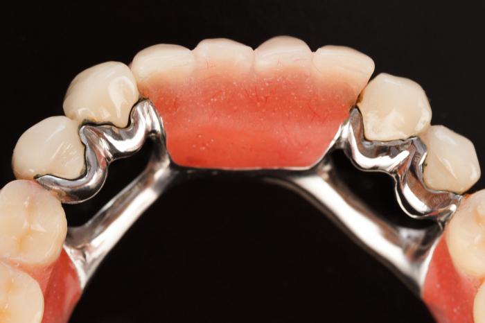 odnímatelné recenze zubní protézy
