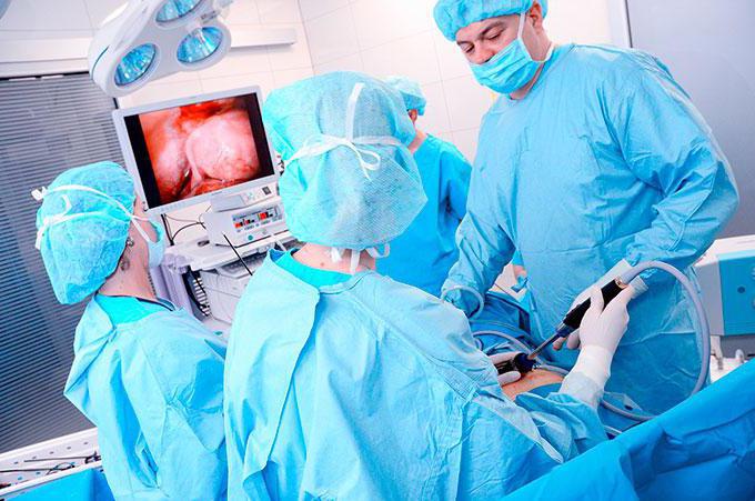 rimozione laparoscopica dell'utero
