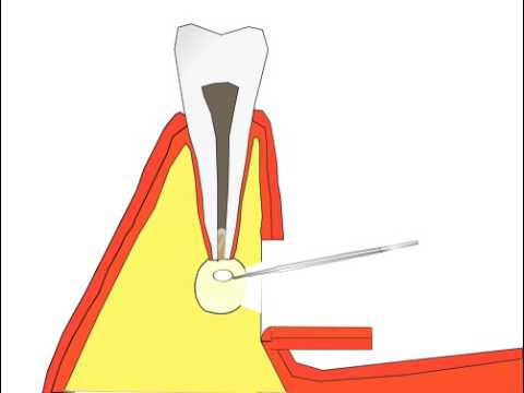 preglede korijena zuba korijena