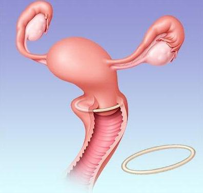 kroužkové novorozené recenze gynekologové