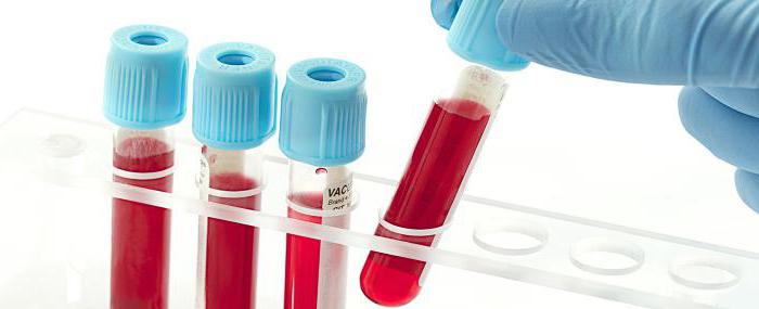 krvni test za rmp, koliko je opravljeno