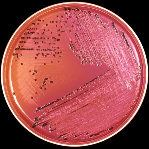 Бактериофаг на Salmonella