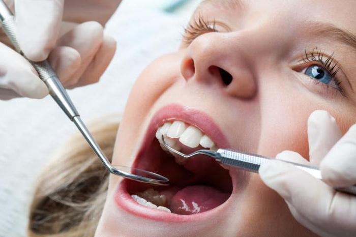 sigillatura fessura nei dentisti di recensioni dei bambini