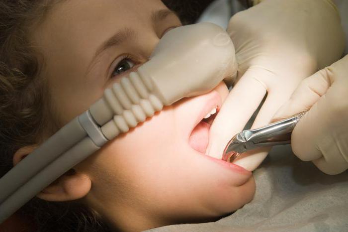 седација у стоматологији
