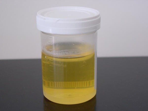 talog urina