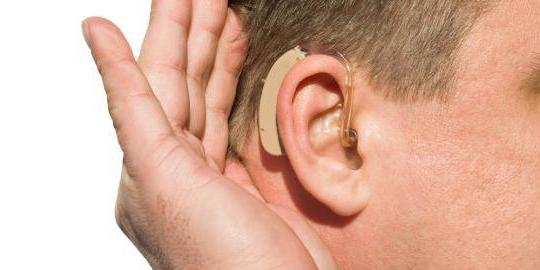 сензоринурални губитак слуха 2 степена