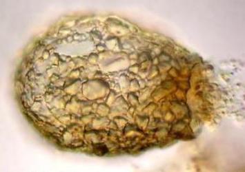 wartość amoebas powłoki