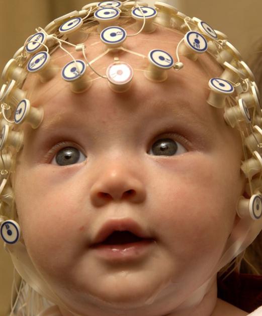 commozione cerebrale nei bambini sintomi segni trattamento