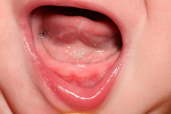 zobje pri otrocih zobje