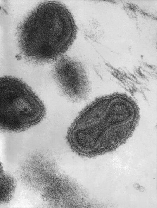 virus variole