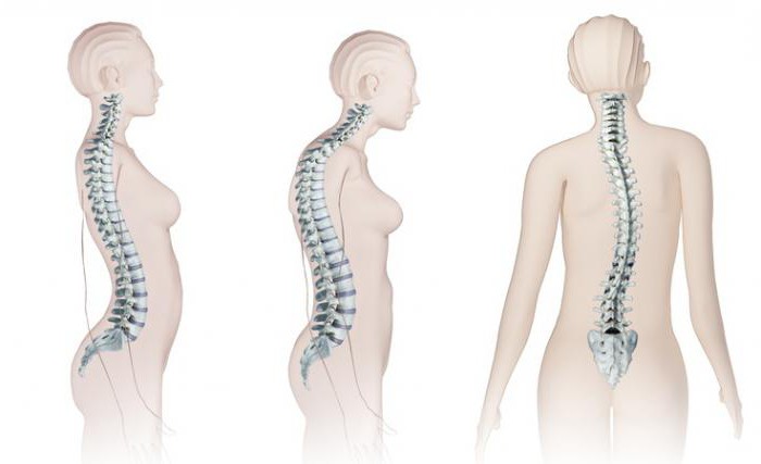 извивки на гръбначния стълб