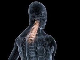 Deformira spondilozo vratne hrbtenice