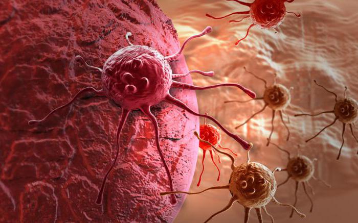 rakovinu pankreatu s jaterními metastázami