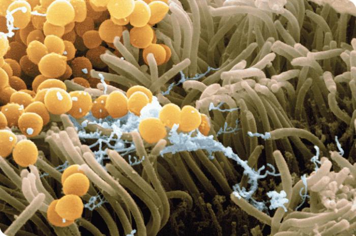 Staphylococcus aureus u crijevima