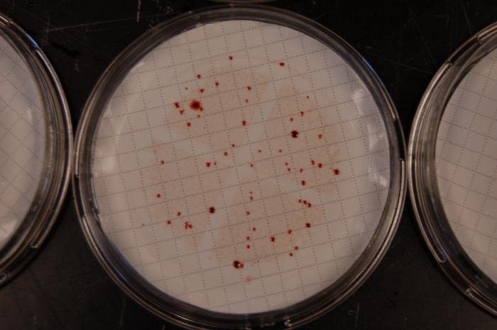 Staphylococcus aureus u crijevima dojenčadi