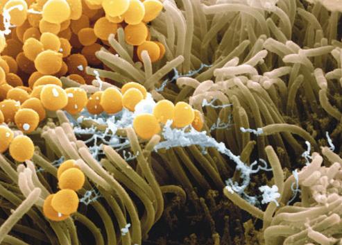 Staphylococcus aureus v nosu