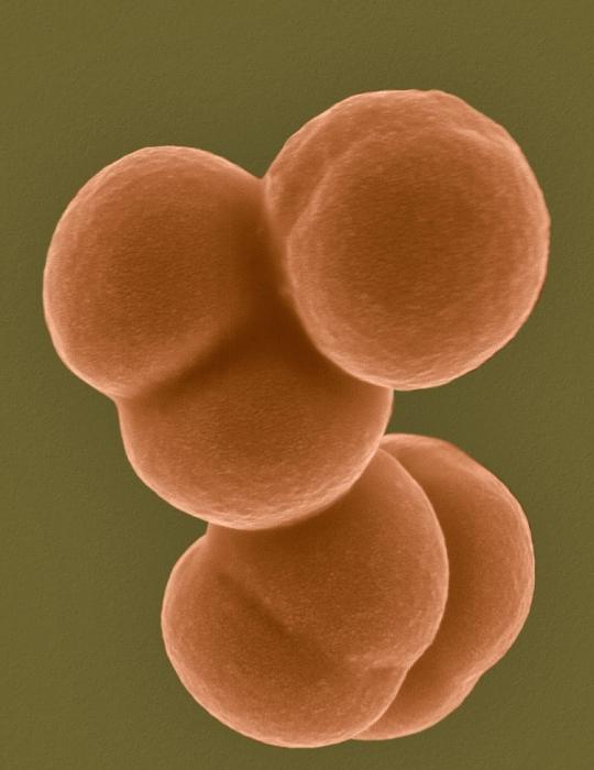 Норма на Staphylococcus aureus